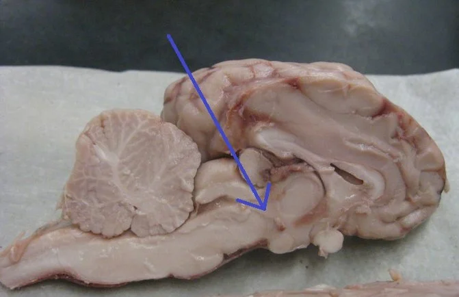 Hypothalamus may protect the aging brain
