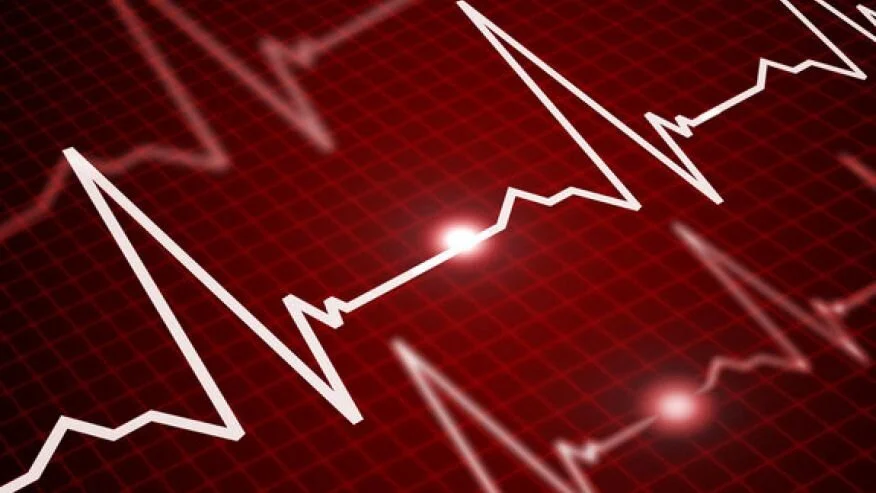 Dementia risk by over-medicating irregular hearbeat