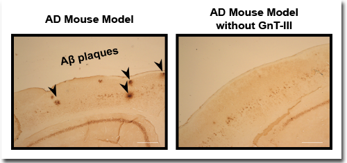 Alzheimer's plaques reduced by targeting sugar attachment to BACE1 enzyme