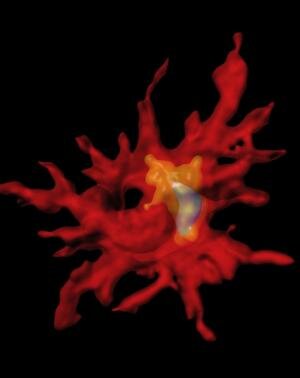 Harnessing immune cells to clear Alzheimer's plaques