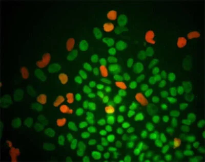 A Shot of Young Stem Cells Made Rapidly Aging Mice Live Longer and Healthier