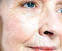 Is Alzheimer’s A Woman’s Disease?