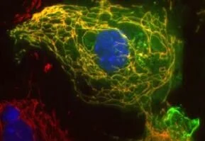 Alzheimer’s cure may be a matter of size