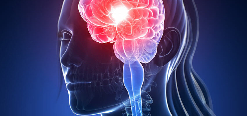 Alzheimer’s Tied to Insulin Problems in the Brain