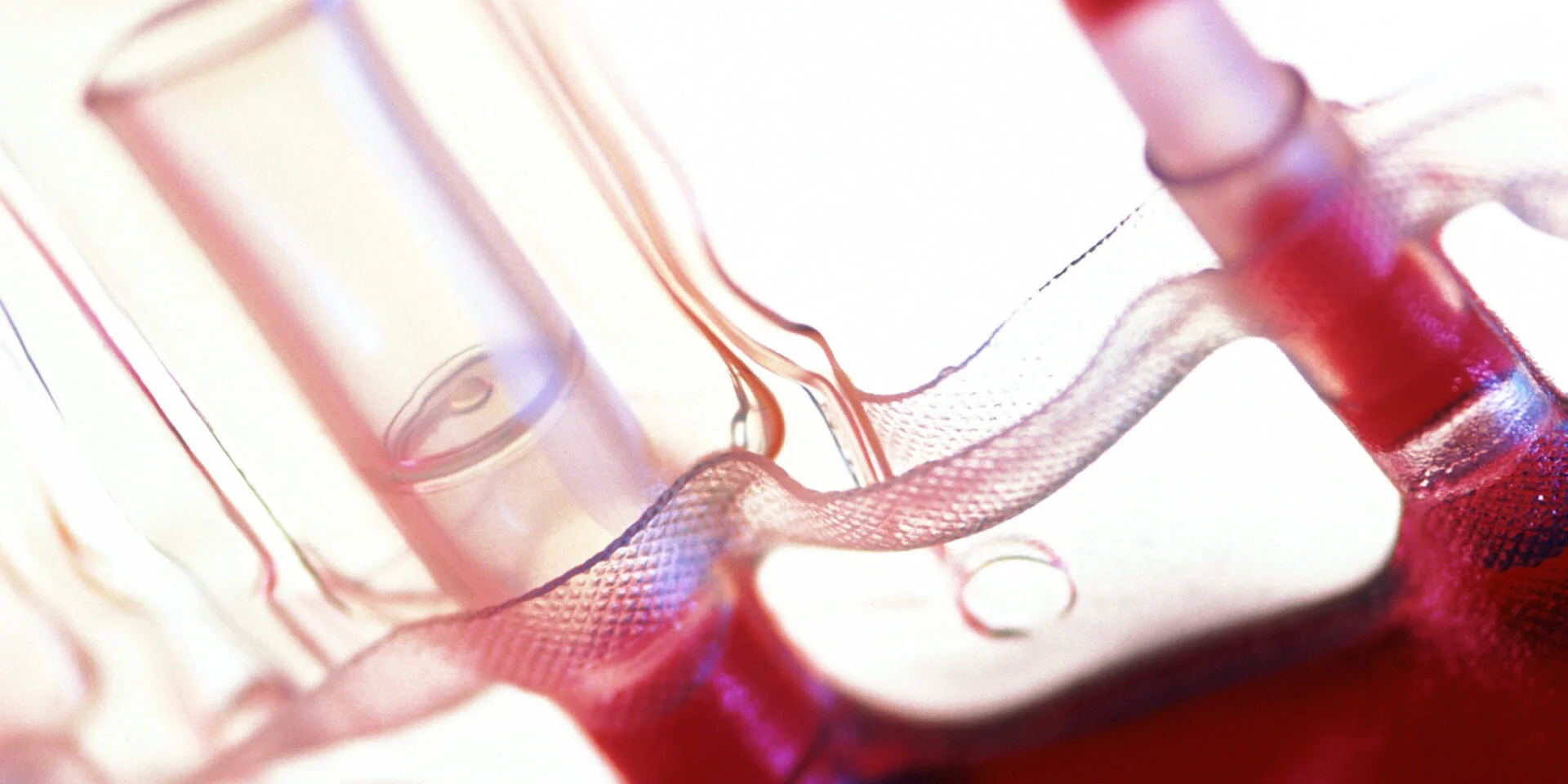 A dose of young blood may stave off Alzheimer's