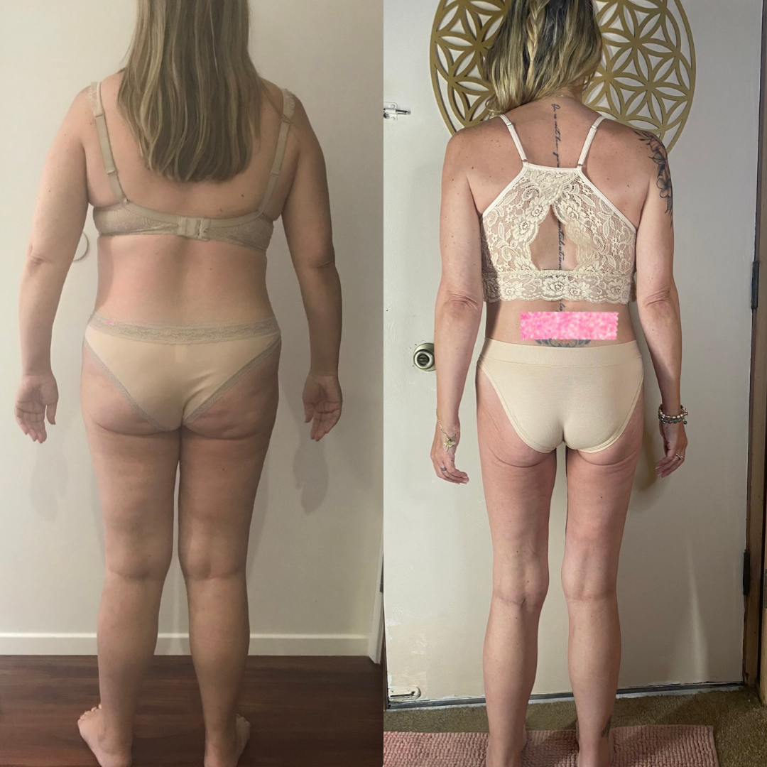 Side-by-side comparison of a woman before and after weight loss, showing her back in beige underwear and a lace top, with visible changes in body shape.