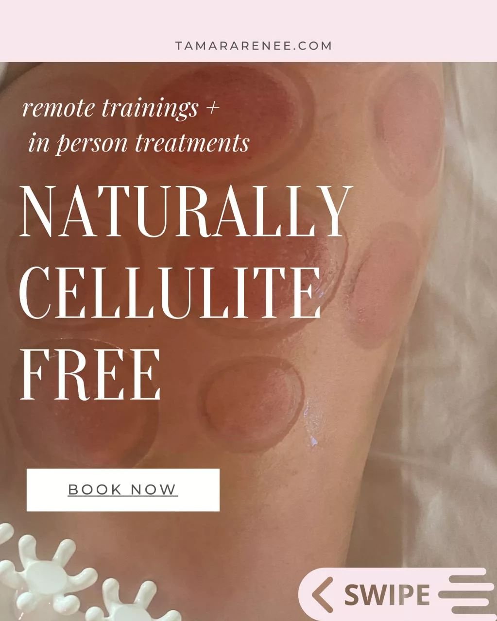 🌿🌟 Hey there, lovely people! 💫✨ Let's talk about the amazing power of natural solutions for banishing cellulite! 🌻💪

💻🏠 Remote trainings are my jam! 🌍💕 With no limitations, I can help anyone, anywhere, say goodbye to cellulite! 🌟💃 Embrace 