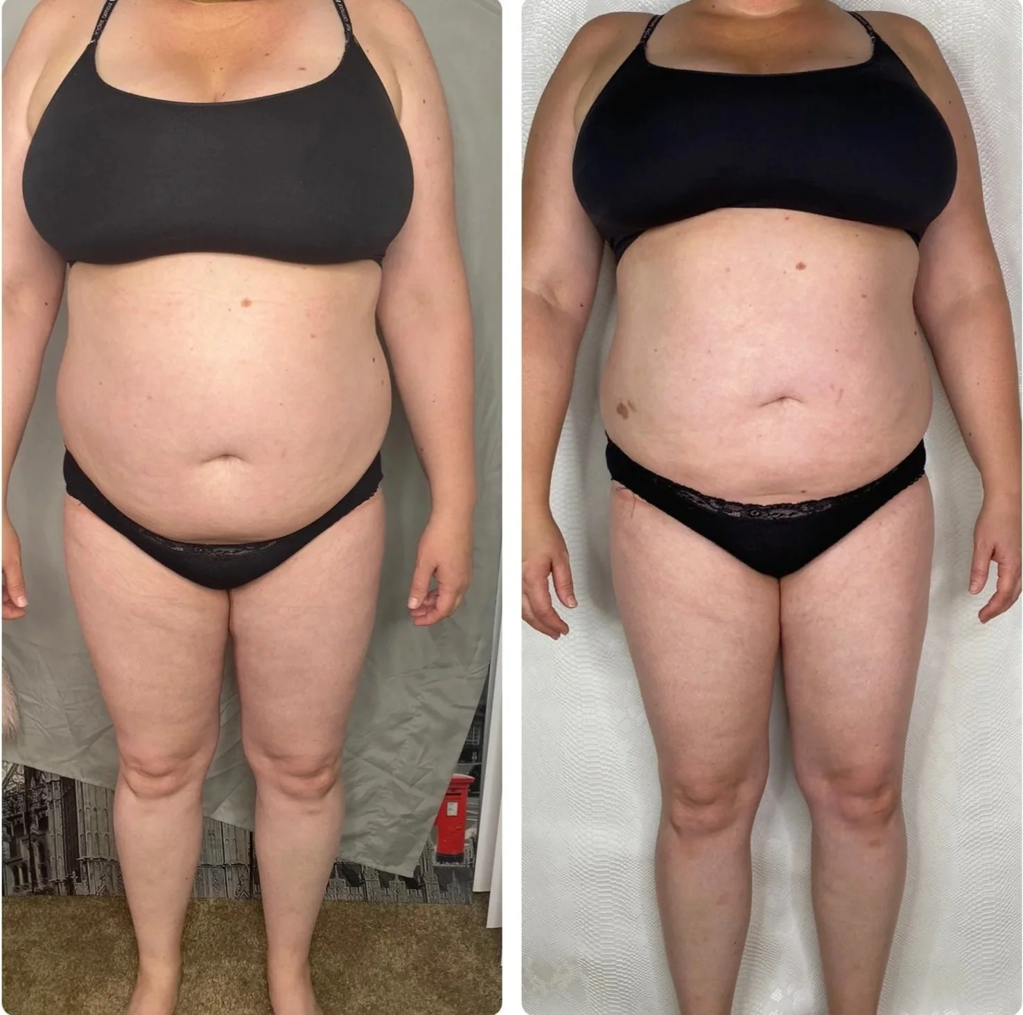 FasciaTHERAPY Body Before & After: Real Client Results