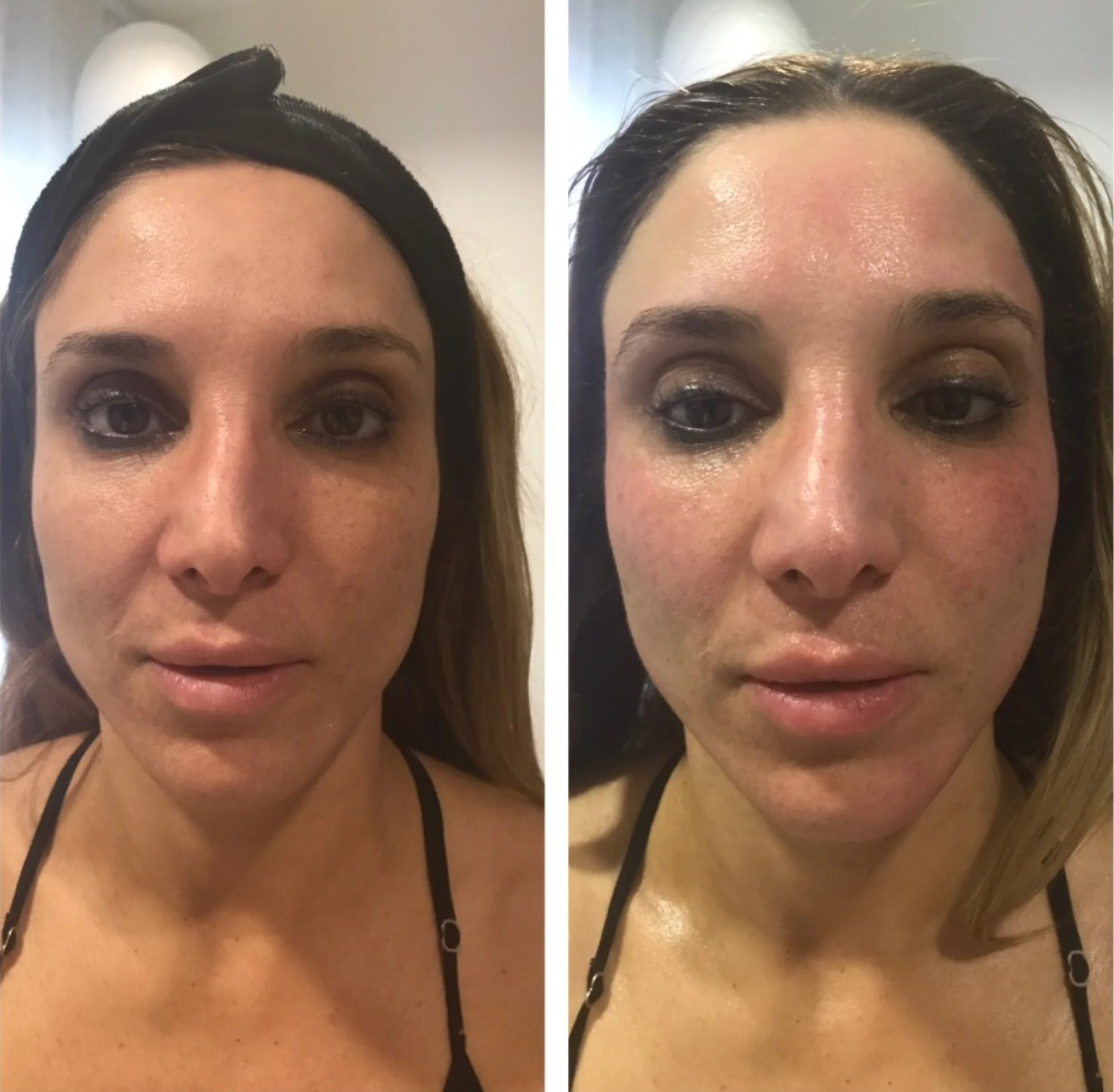 facefirm Before & After: Real Client Results