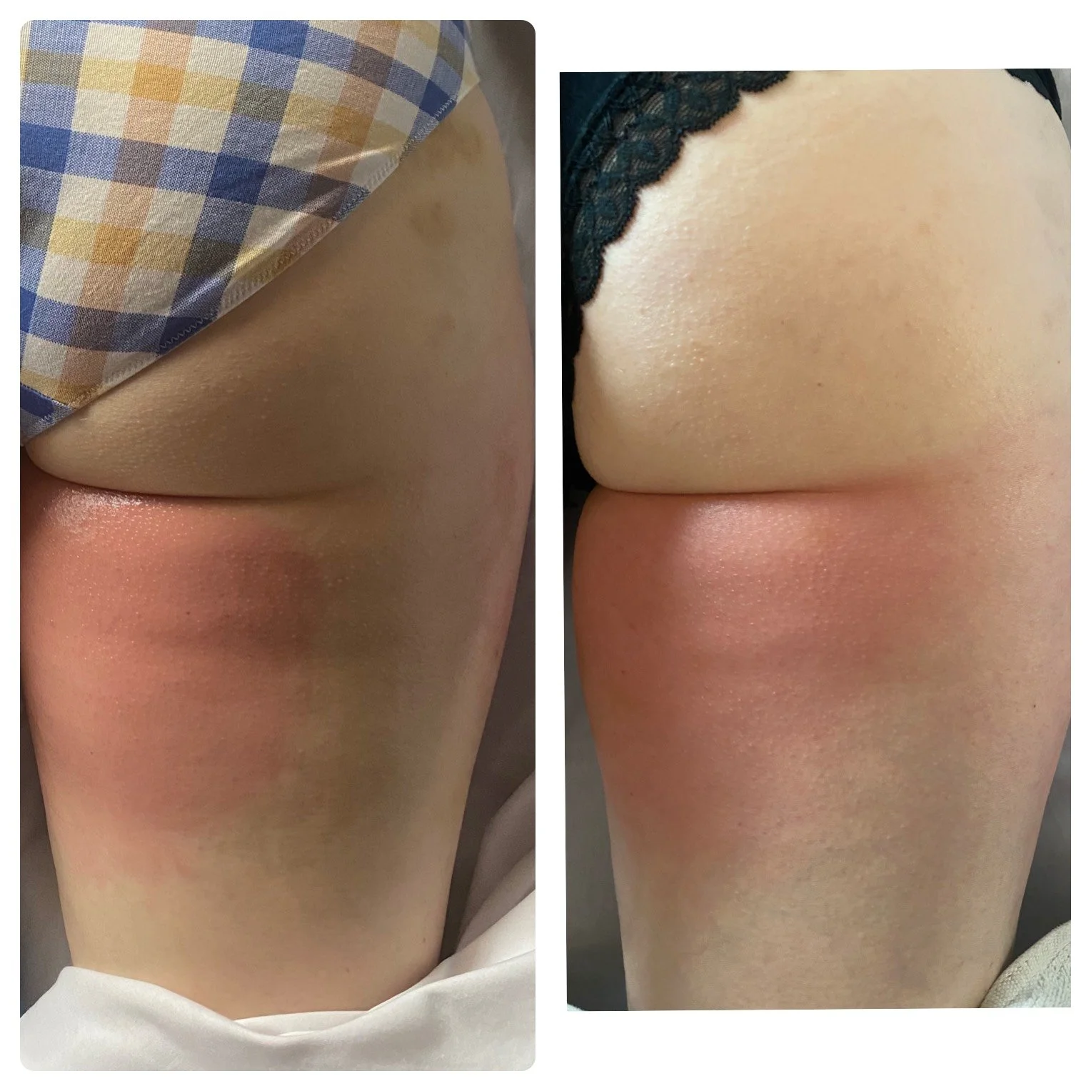 SpoTRIM Before & After: Real Client Results
