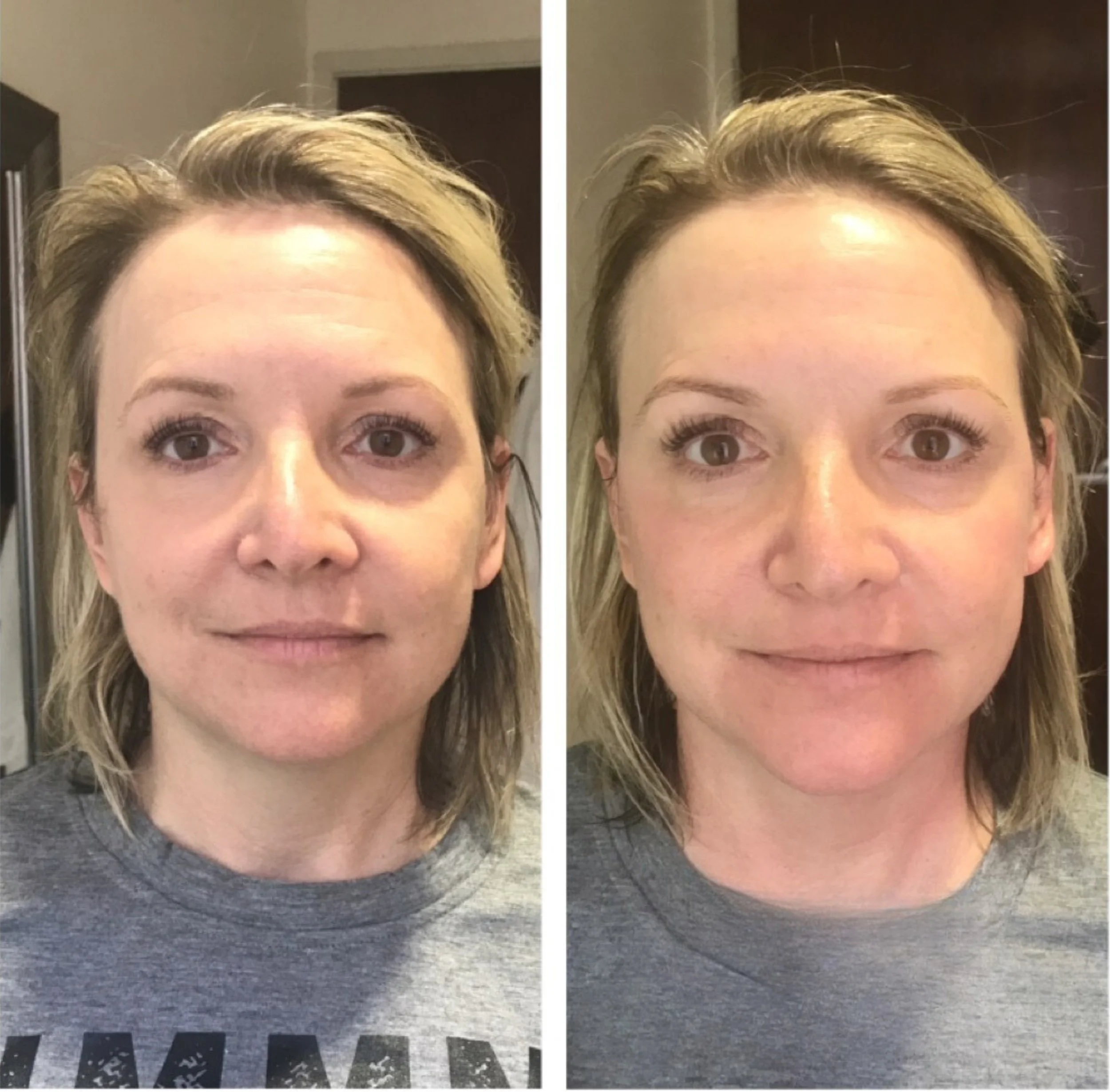 facefirm Before & After: Real Client Results
