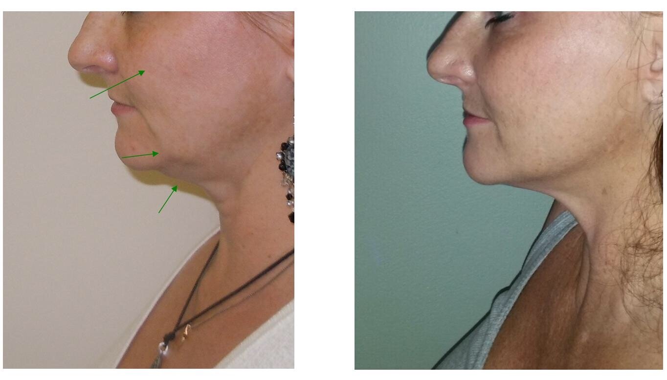 FaceFIRM