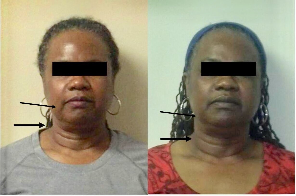 FaceFIRM