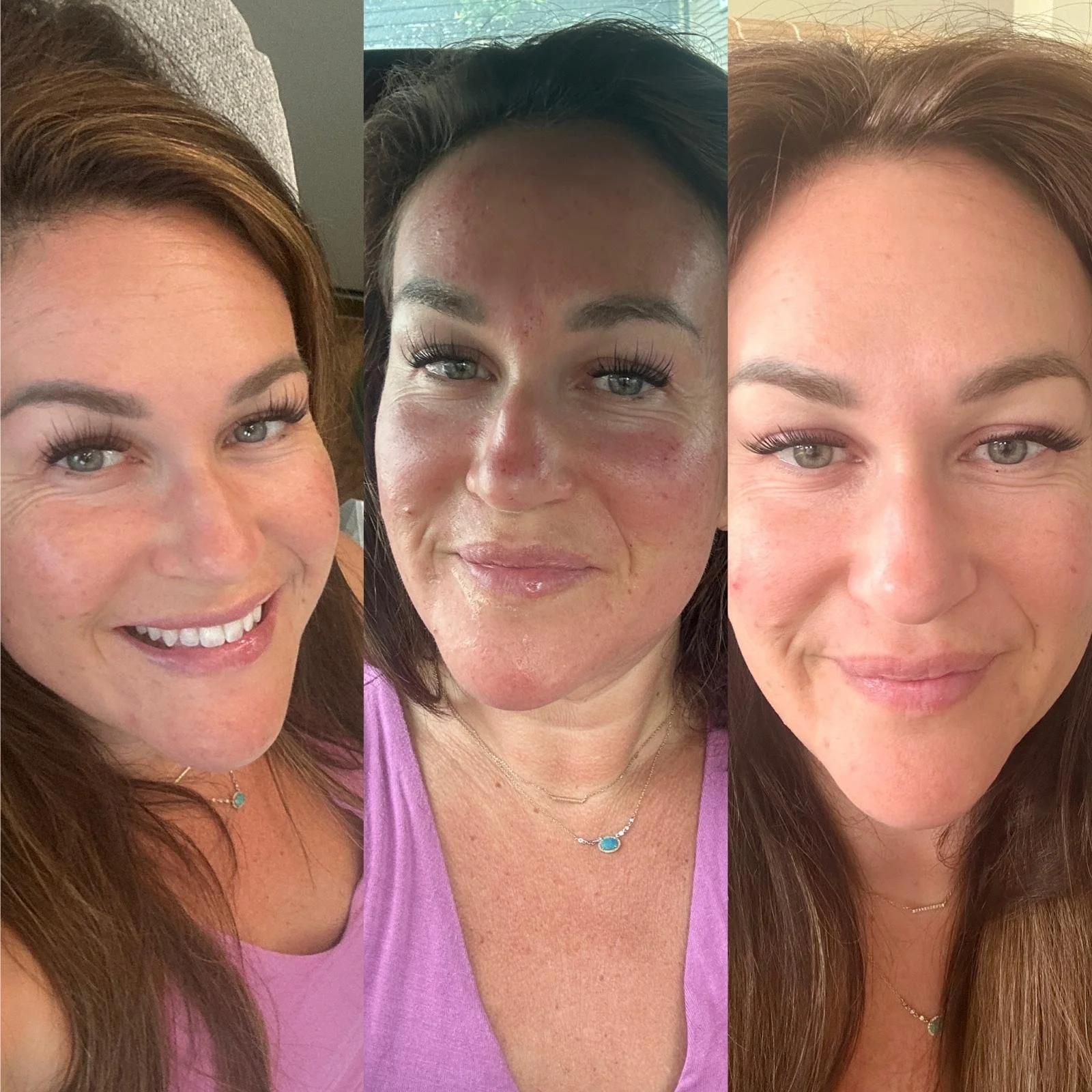 facefirm Before & After: Real Client Results