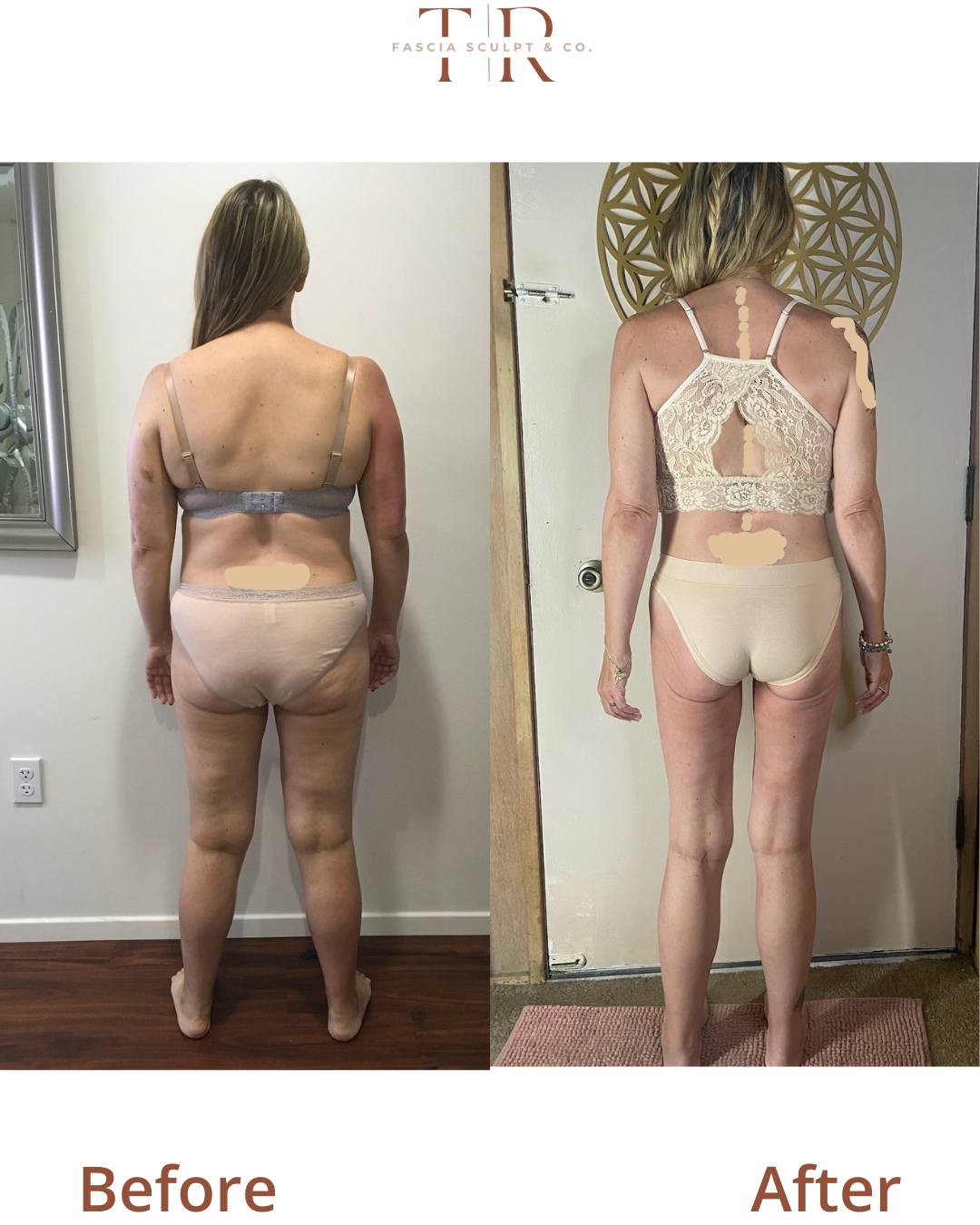 FasciaTHERAPY Body Before & After: Real Client Results