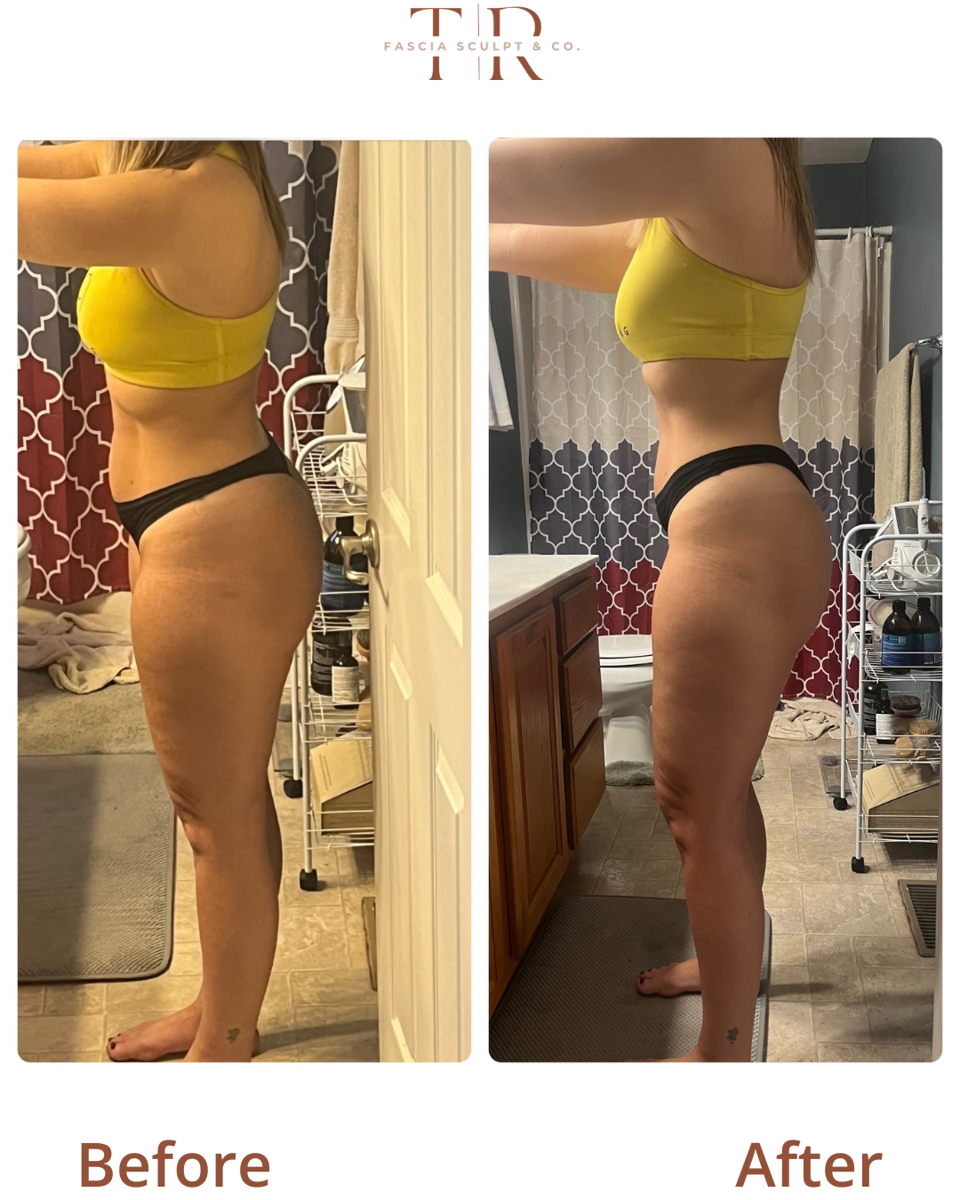FasciaTHERAPY Body Before & After: Real Client Results
