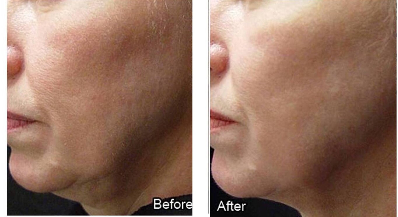 FaceFIRM