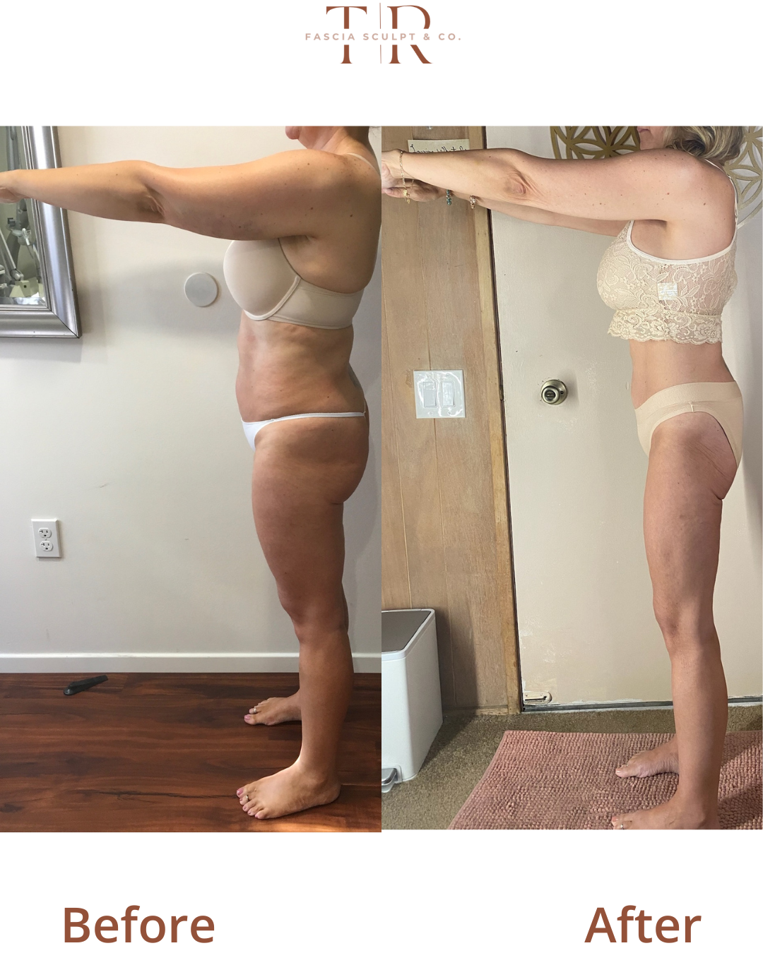 FasciaTHERAPY Body Before & After: Real Client Results