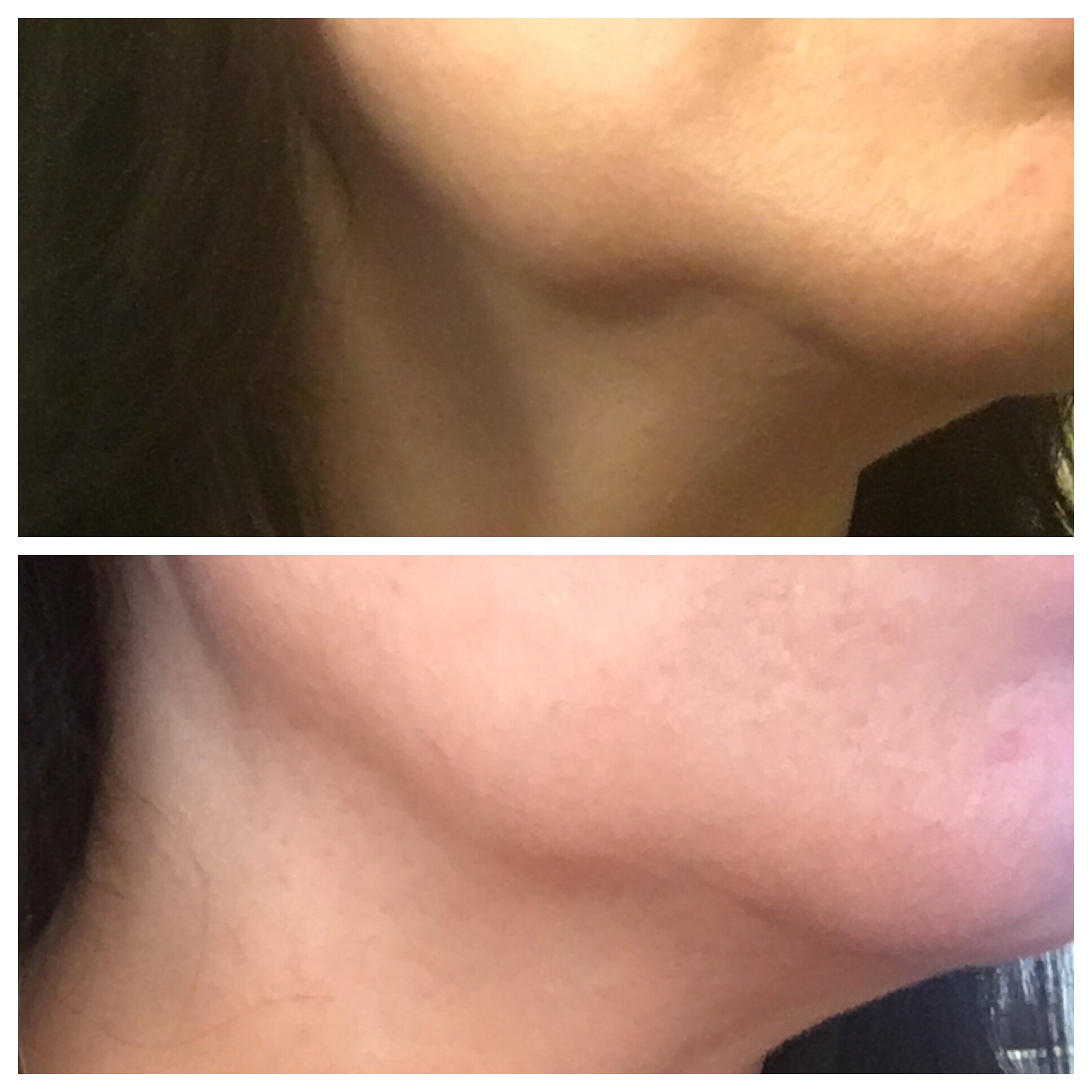 FaceFIRM