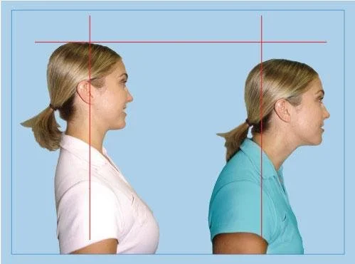 Posture Assessment