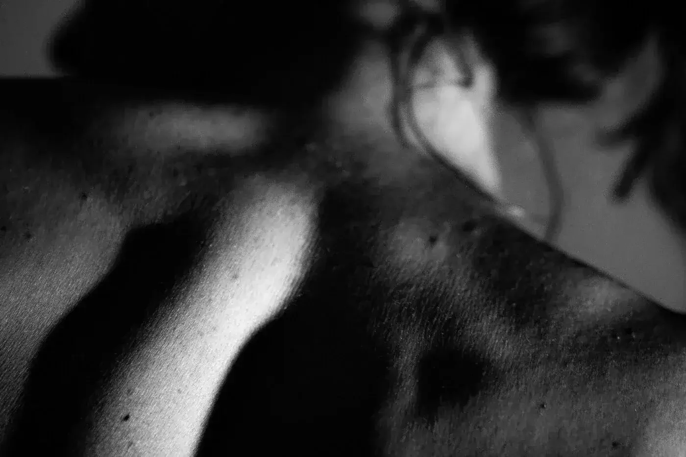 Close-up black and white photograph of a woman's shoulder and part of her face, showing textured skin and a soft focus.