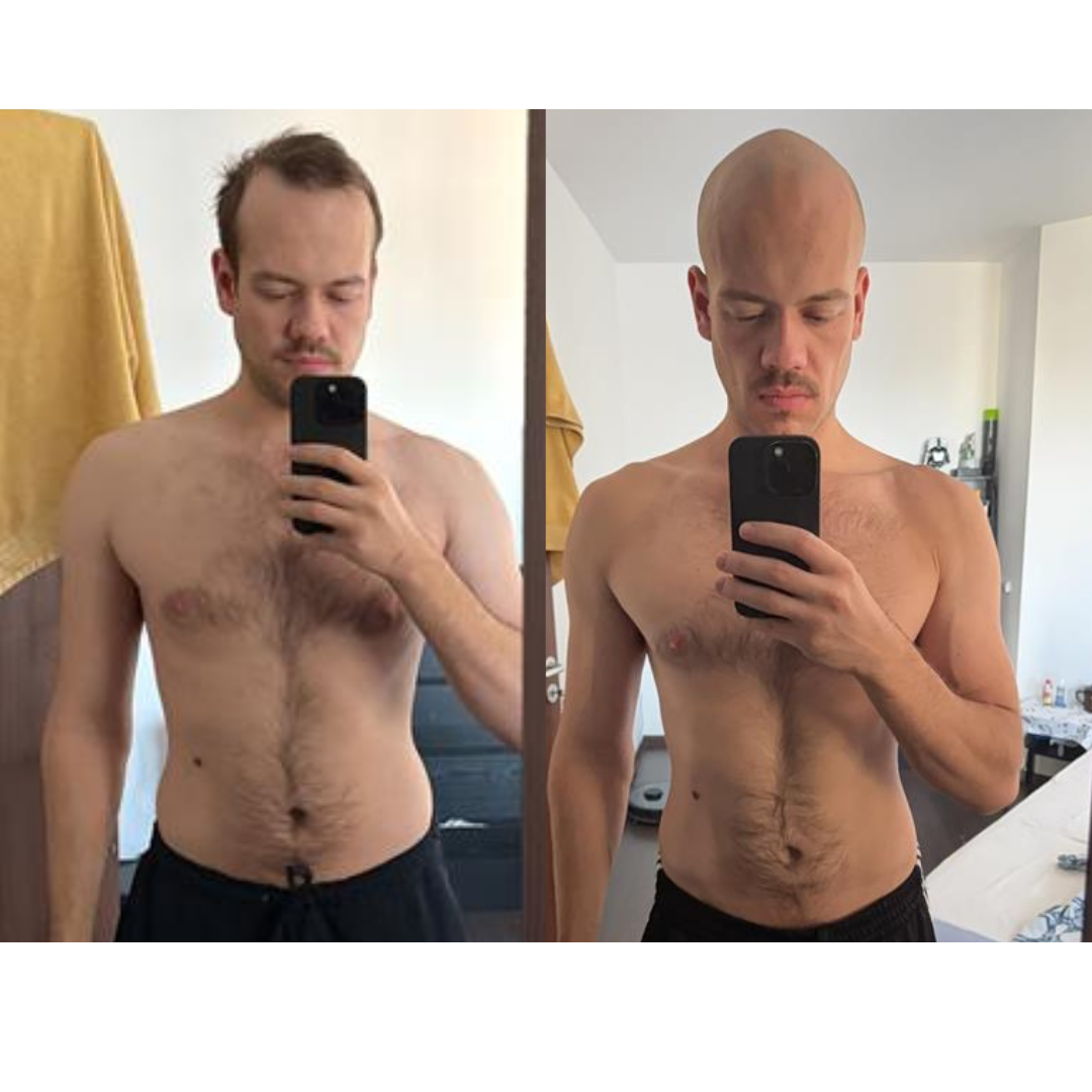 B&A - Random (7).png