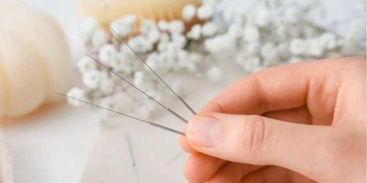 Evidence-Based Acupuncture for Chronic Pain: A Modern Approach to Non-Drug Pain Relief