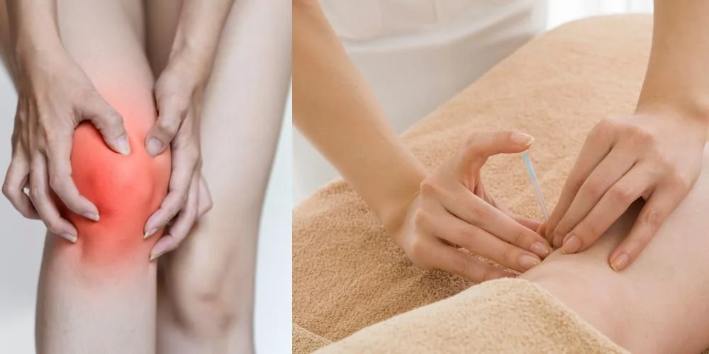 Treat Knee Osteoarthritis with Acupuncture and the Mediterranean Diet