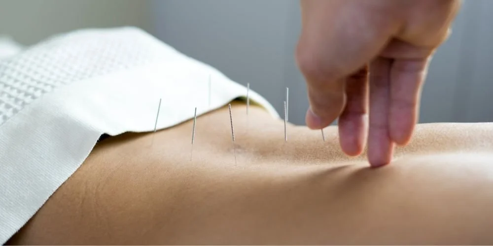 NinaAcupuncture Stress and Anxiety Blog