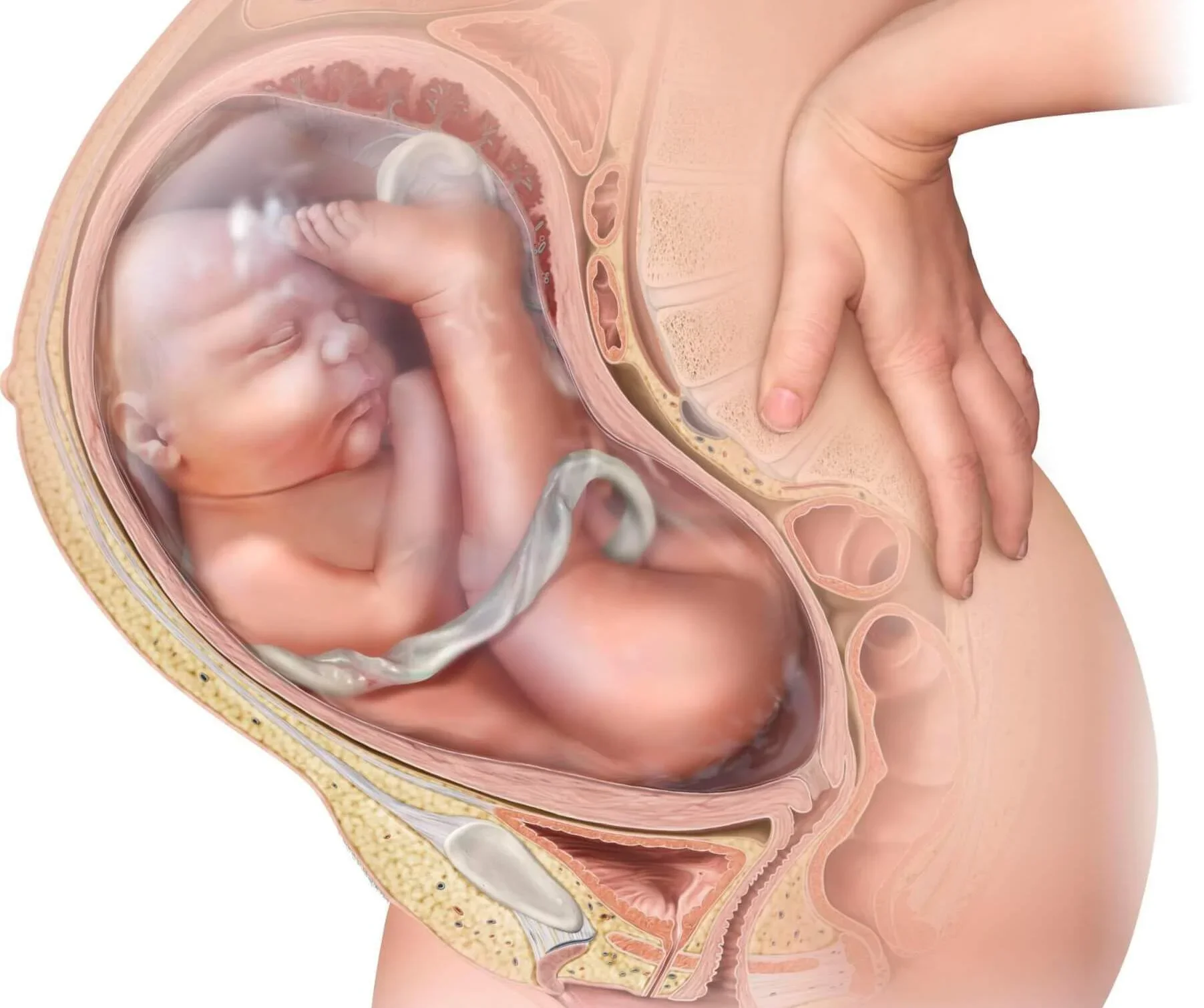 Acupuncture and Moxibustion for Breech Presentation: Can They Help a Breech Baby Turn?