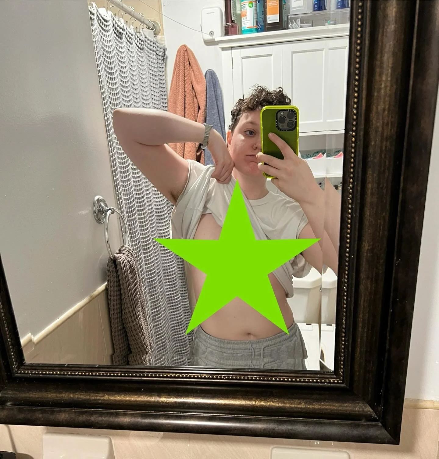 ✨swipe for a top surgery reveal✨

I got top surgery 4 months ago and it changed my life.
🔥Trans ppl r hot &amp; deserve gender affirming care🔥