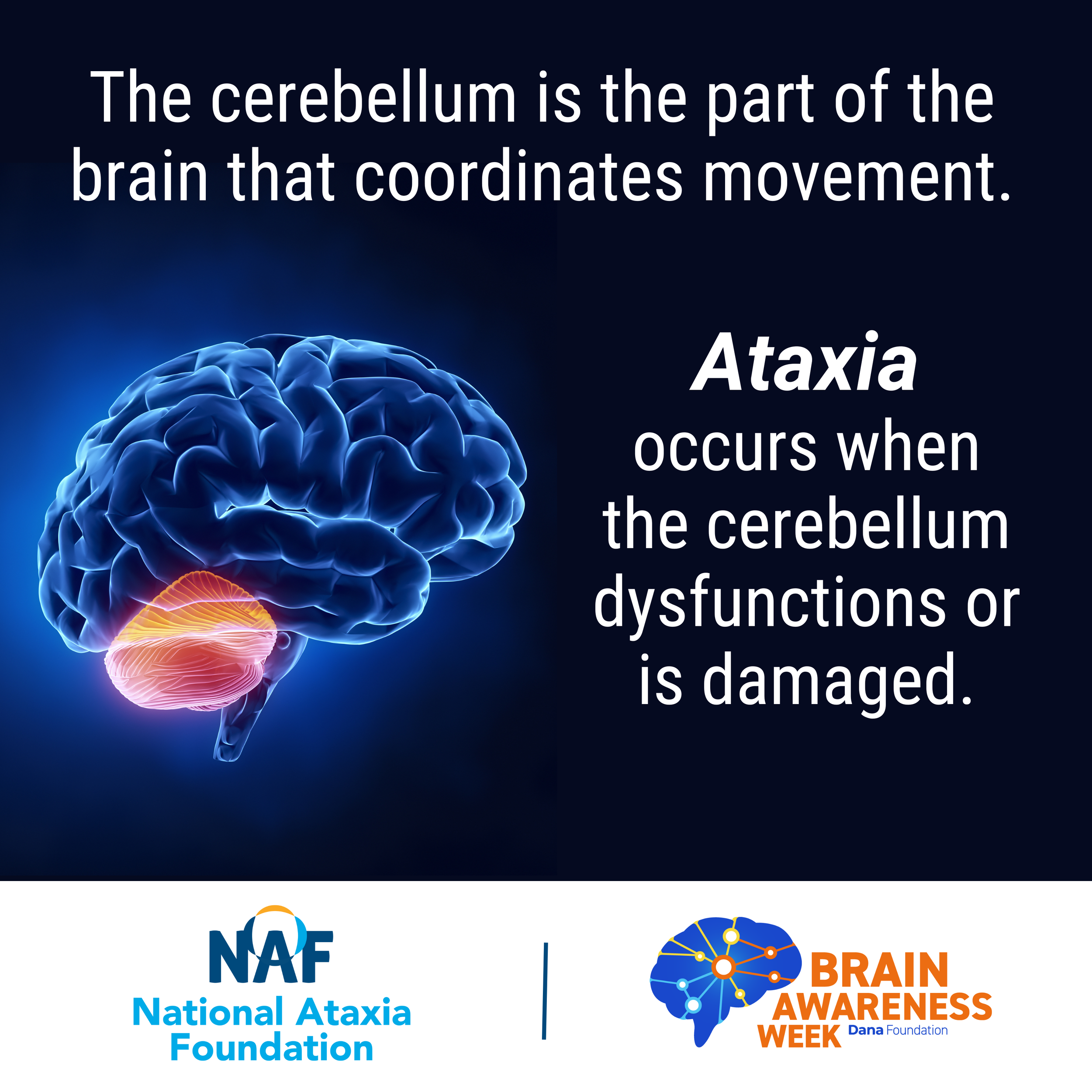 The cerebllum (3).png