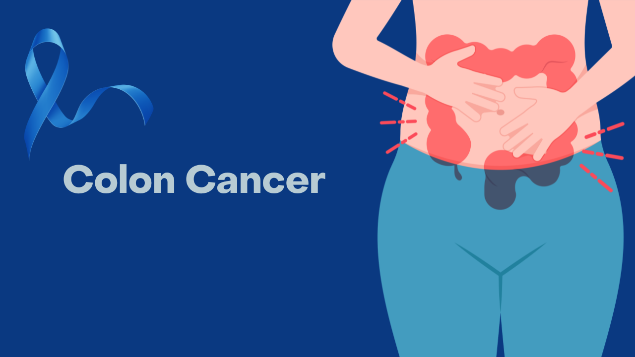 Colon Cancer with Dr. Vaid