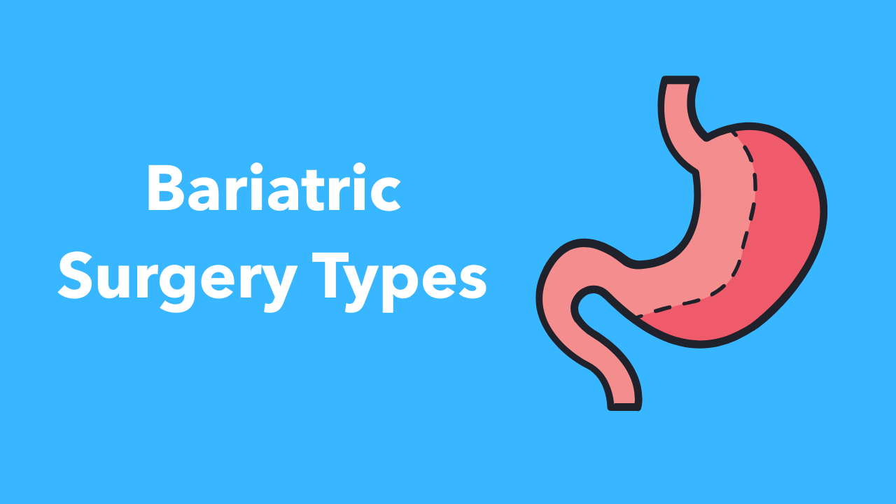 Bariatric Surgery Types &nbsp;