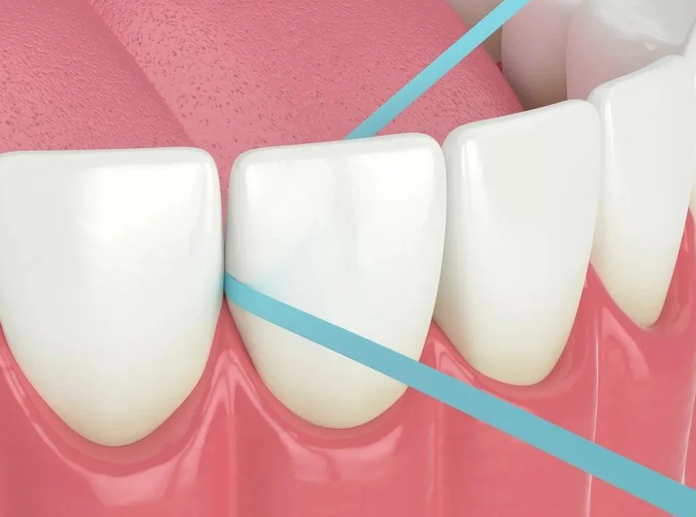 Diagram showing C-shape flossing technique around teeth - How to Floss with Braces in Westfield, IN