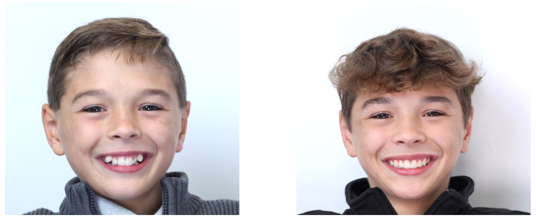 two smiling children shown side by side in a portrait style image - How to Get Braces Glue Off Teeth in Westfield, IN