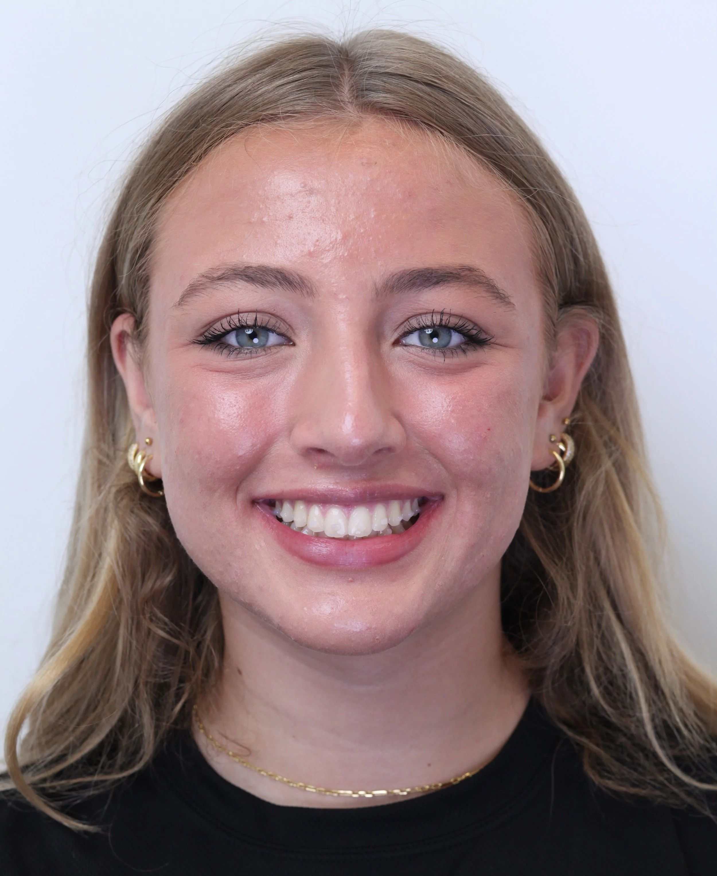 Smiling young woman office portrait – Can Invisalign Fix Overbite in Westfield, IN.