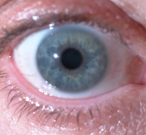 Blue eye