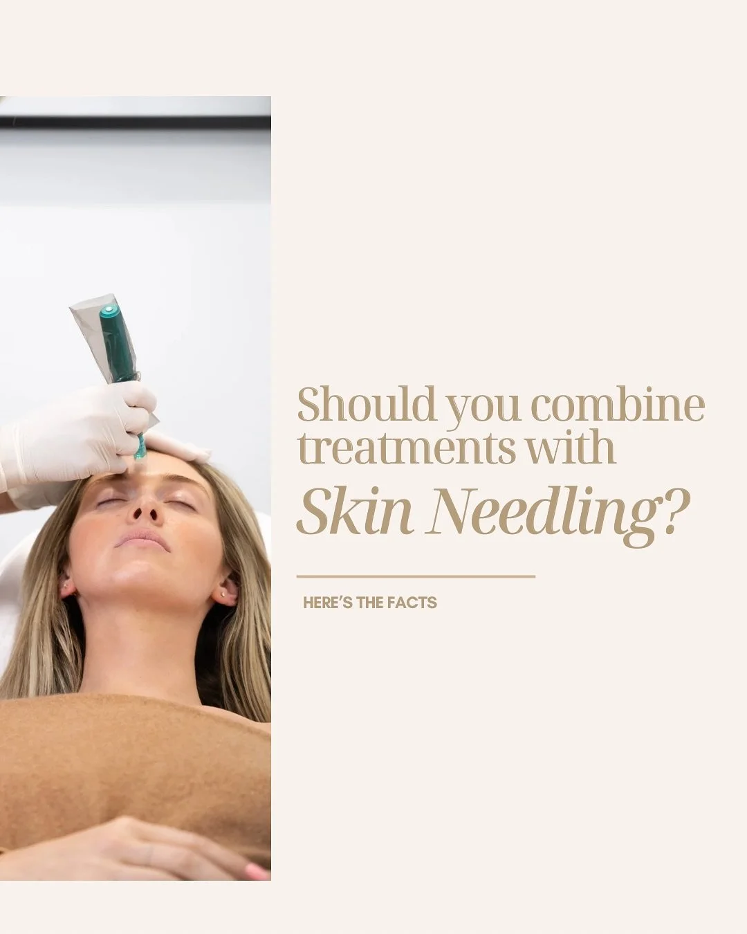 💭Thinking about combining treatments with needling? 

While it can be beneficial when planned correctly, your complexion needs time to rest, repair, and respond between each session.&nbsp;

✨ Here&rsquo;s what to keep in mind:  ✔️ Always start with 