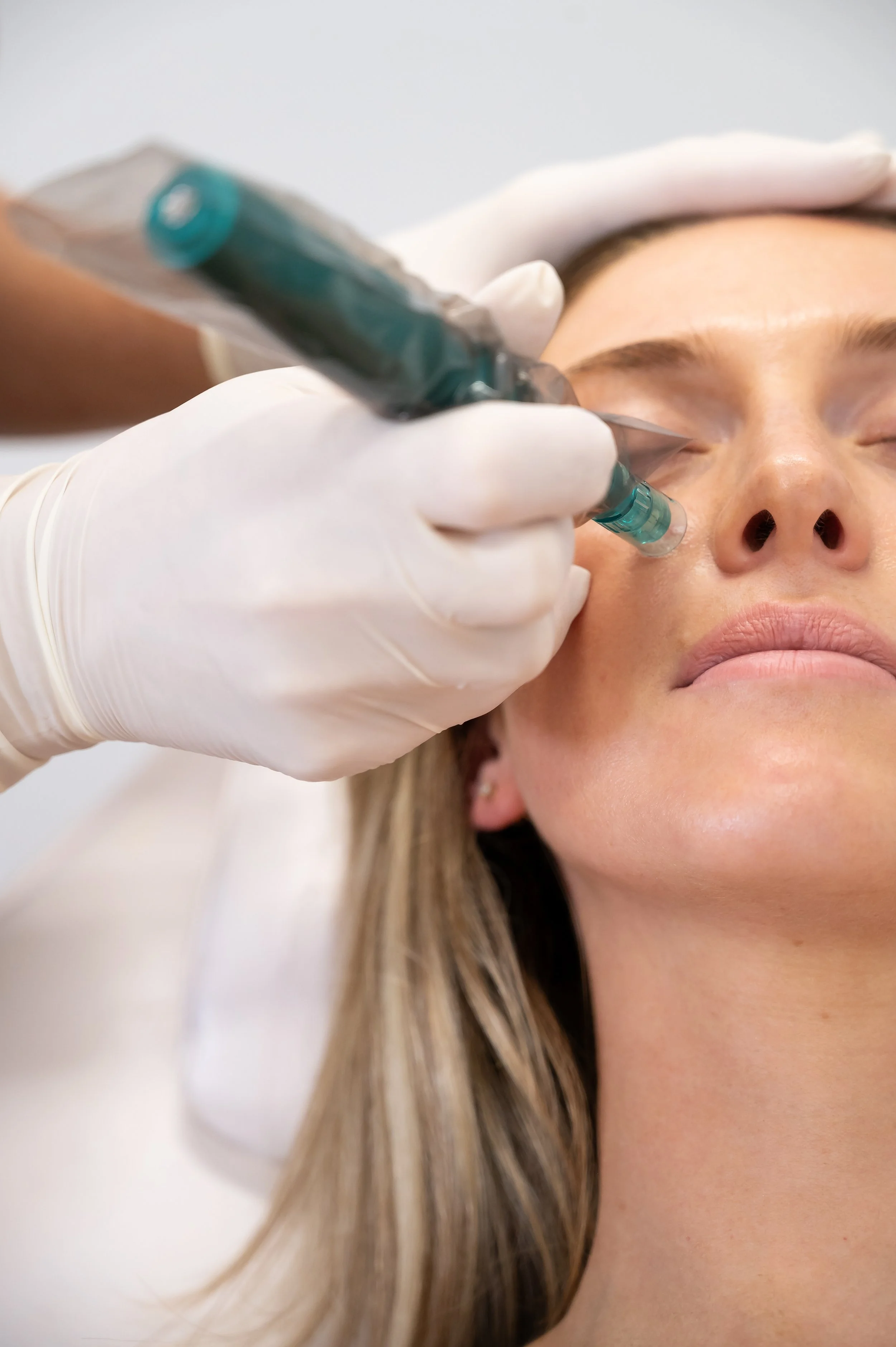 Can Skin Needling Support Collagen Production? A Clinical Perspective