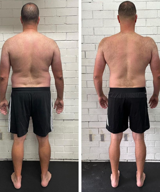 Side-by-side comparison of a FP Sydney client showing improved posture, back and shoulder decompression and weight loss