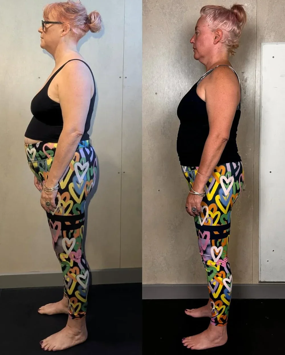 Comparison of a woman before and after. On the left she has a forward head posture, curved back, bloating and was in pain. On the right image she has improved posture, has lost weight, her head posture is neutral and she stands straighter.