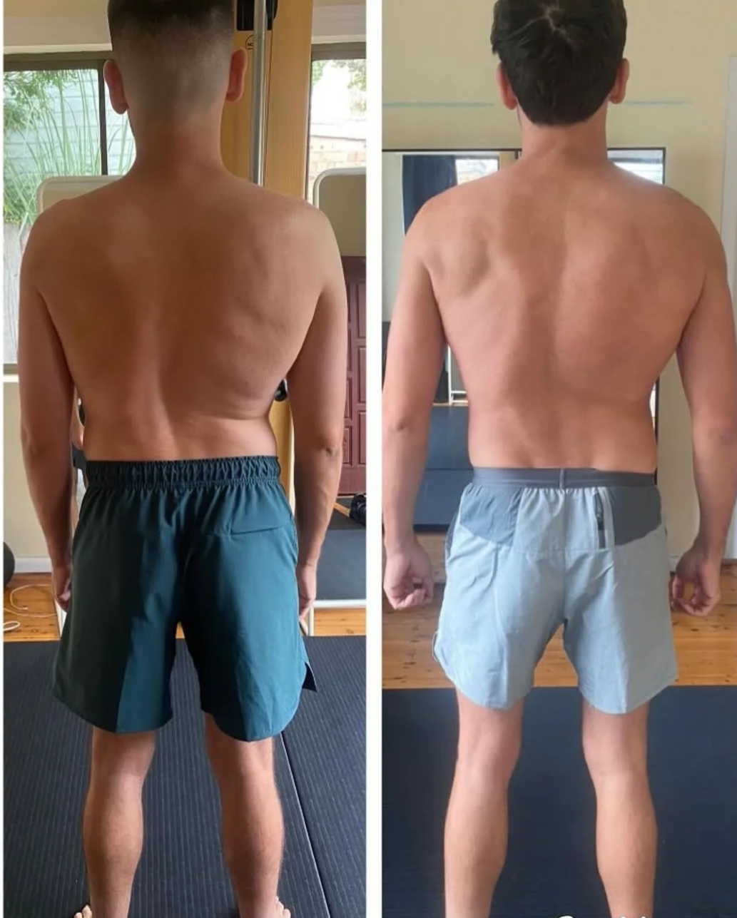 Comparison of a FP Sydney client. On the left he has a pronounced scoliotic curve in his spine, a compressed lower back. On the right he has a reduced curve in his spine and his back is decompressed.