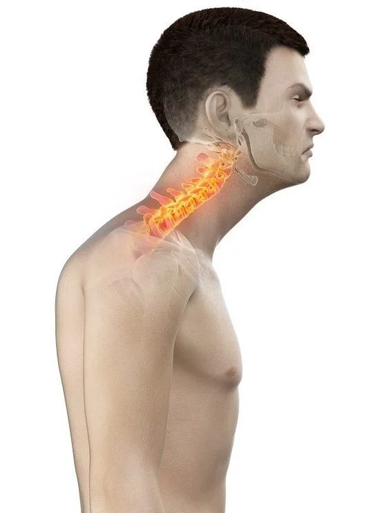 An illustration of a man with an exposed neck and head area showing the cervical spine glowing in orange, highlighting the dysfunctional posture he has developed