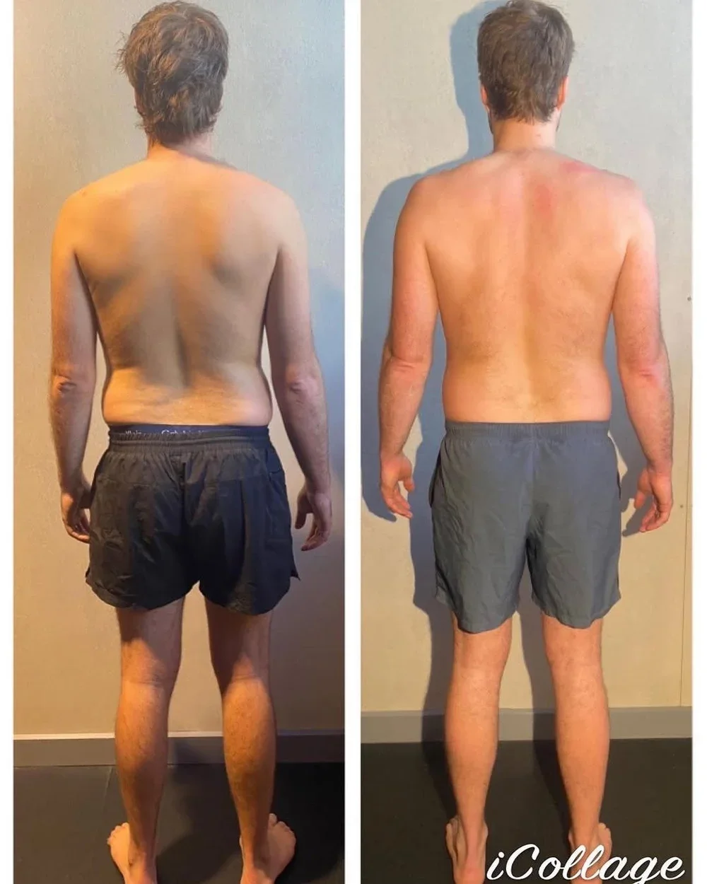Comparison of a FP Sydney client who has Ankylosing Spondylitis. Not eh left image he has a compressed lower back and scoliosis. On the right his lower back is decompressed and he has more muscle definition