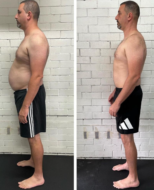 Before and after comparison of a FP Sydney client showing a side on view of weight loss, straighter posture and improved neck and shoulder positioning