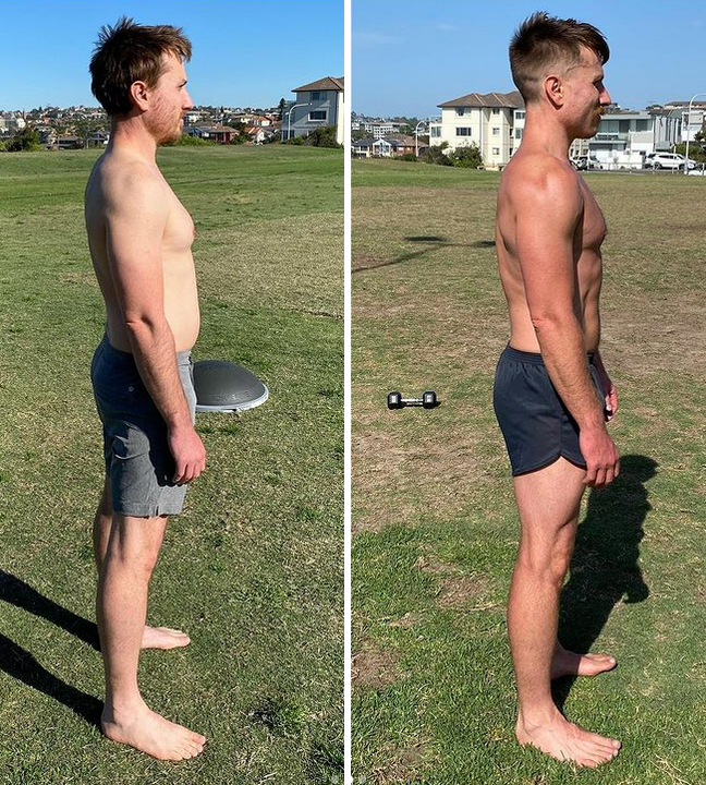 A FP Sydney client showing a side on photo of their posture improvements. Initial thoracic and cervical compression has been reduced and they stand taller and are more stable