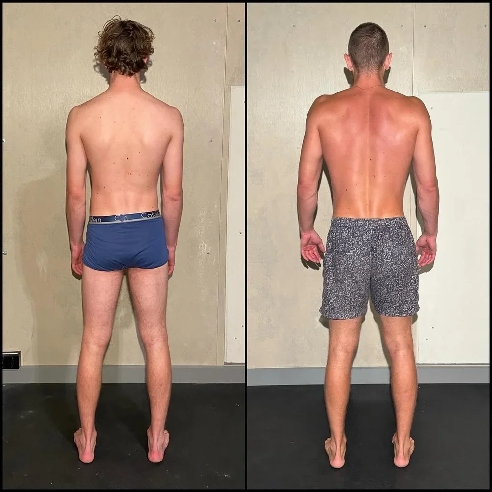 Before and after photos of a man with scapular winging and hip hike posture issues and how he has transformed his body, fixed issues and gained muscle