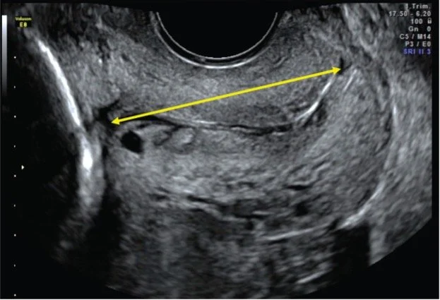 The Only One — Screening and Discussion Launch