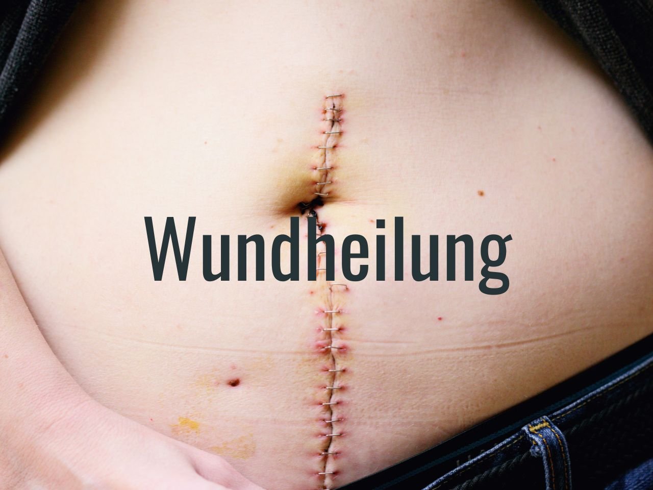 Wie Du die Wundheilung nach einer OP oder Verletzung unterstützen kannst.